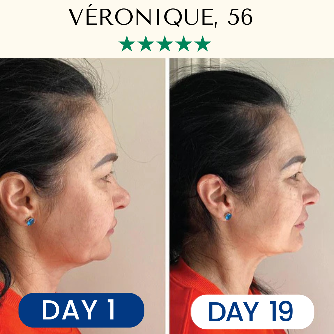 Lifting & Firming Reusable Face Mask Fontanay™