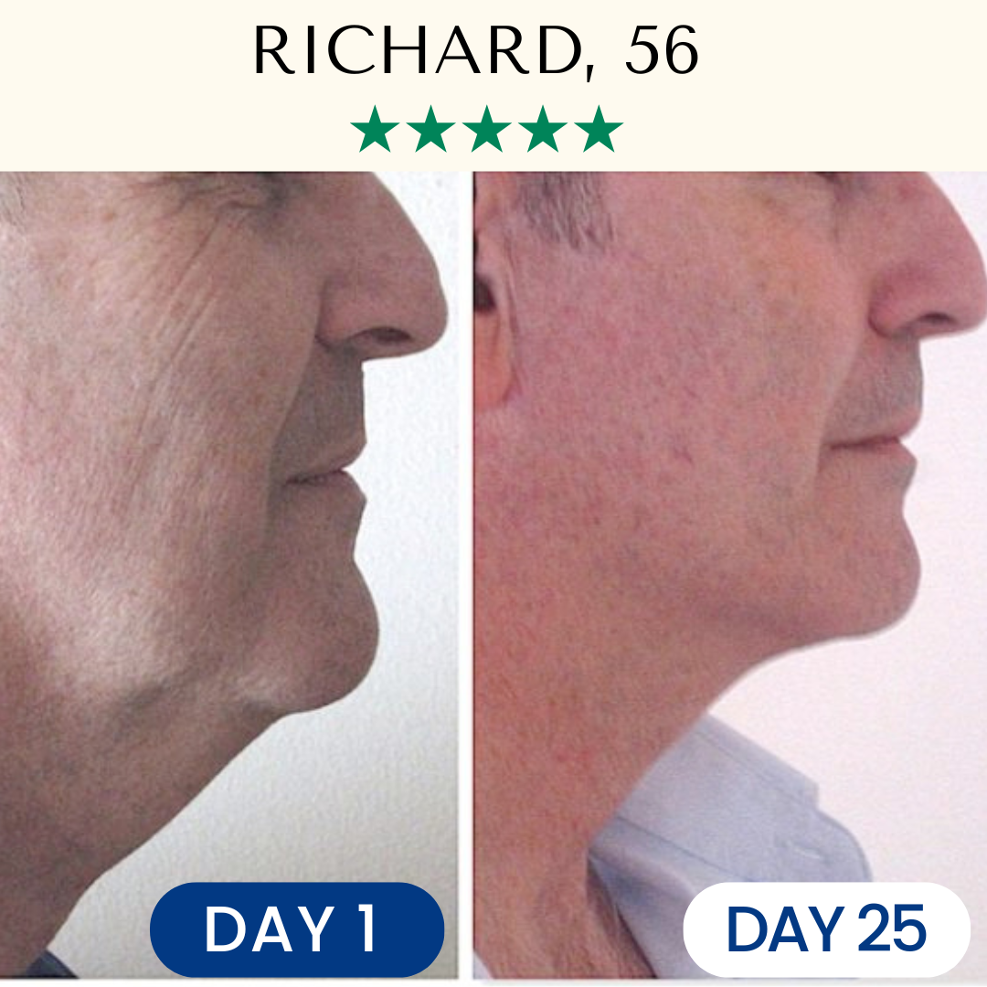 Lifting & Firming Reusable Face Mask Fontanay™