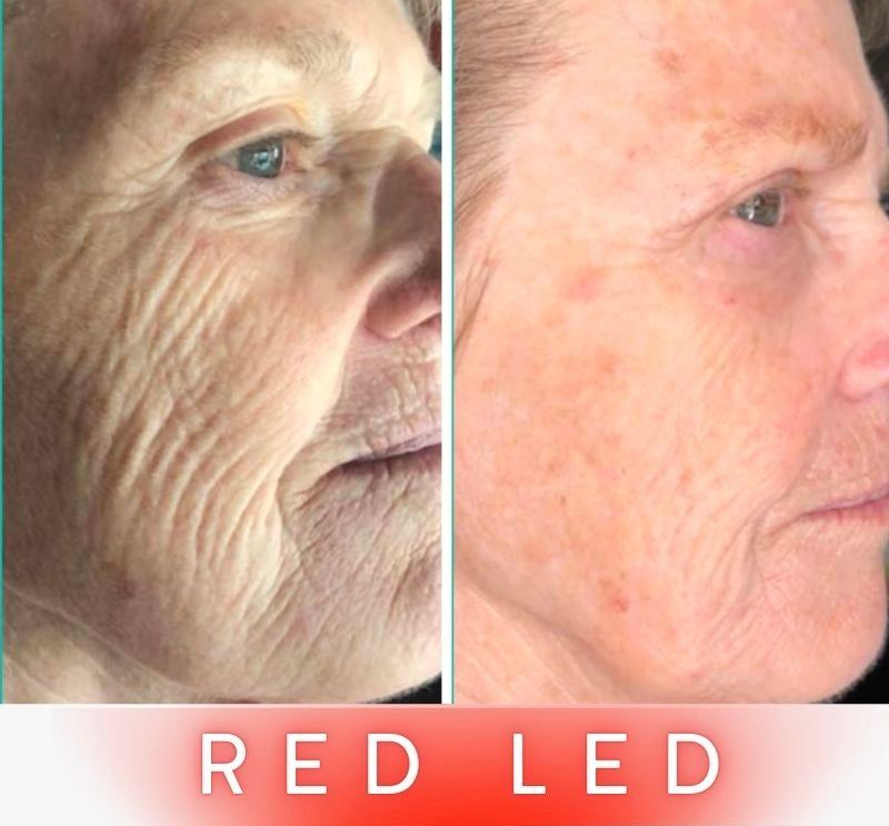 LED Anti-Ageing Mask Pro - Face