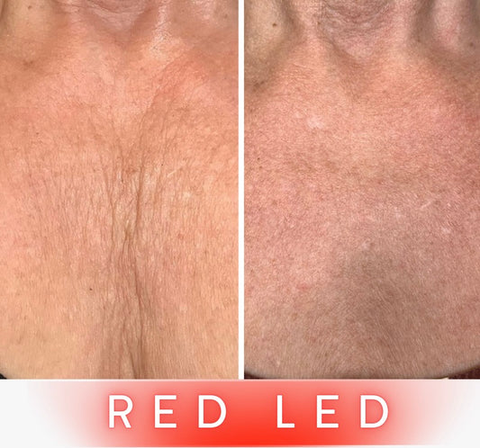 LED Anti-Ageing Mask Pro - Neck and Chest