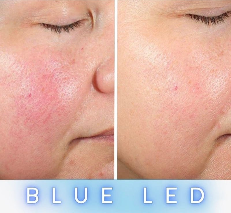 LED Anti-Ageing Mask Pro - Face
