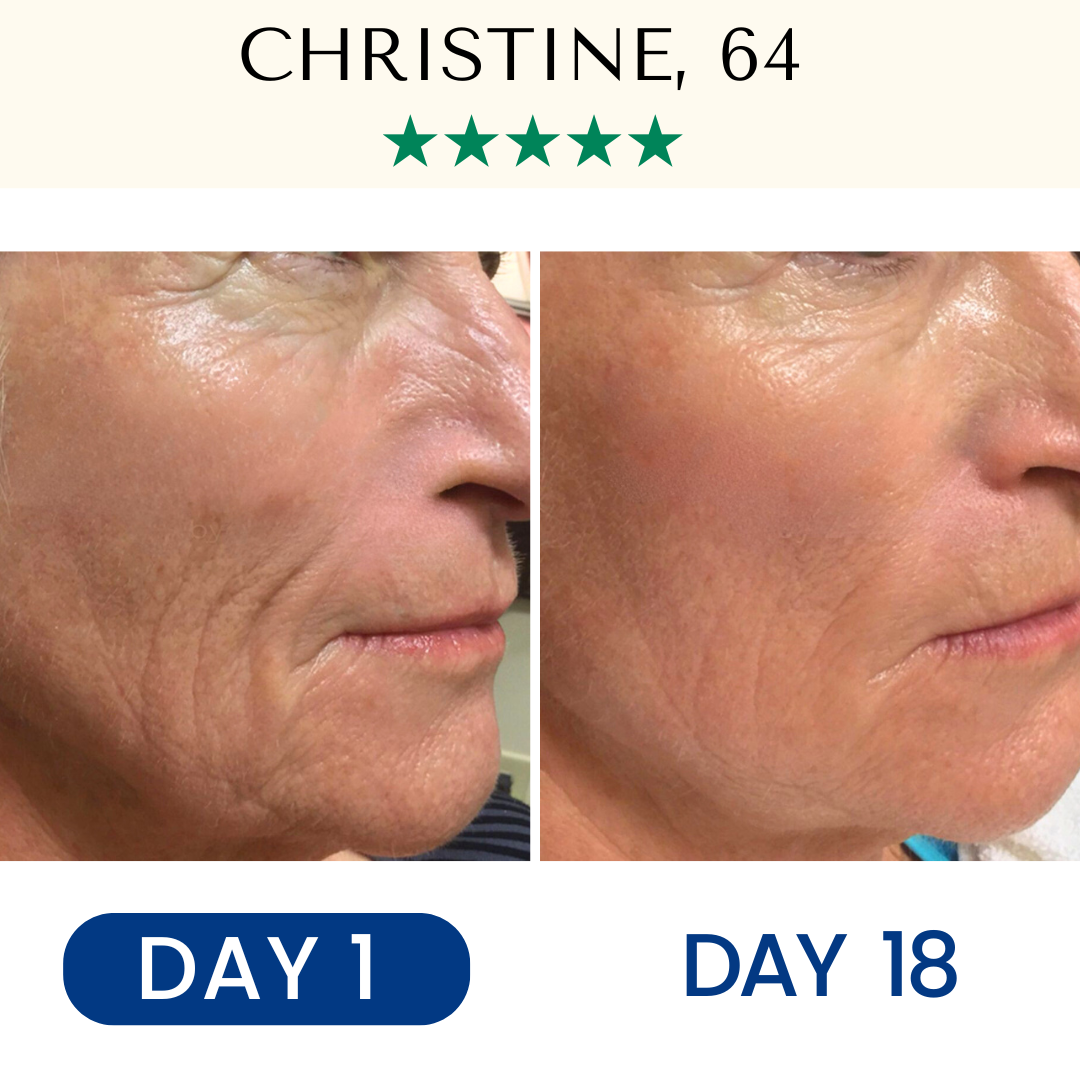 Lifting & Firming Reusable Face Mask Fontanay™