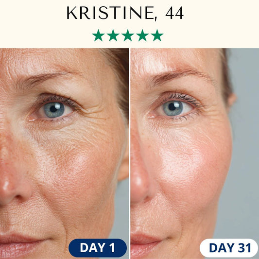 LED Anti-Ageing Mask Pro - Face