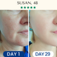 LightPro 7in1 Fontanay™ Lifting Light Therapy
