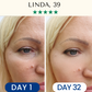 LightPro 7in1 Fontanay™ Lifting Light Therapy