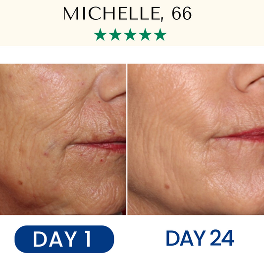 LightPro 7in1 LED Lifting Anti-Ageing
