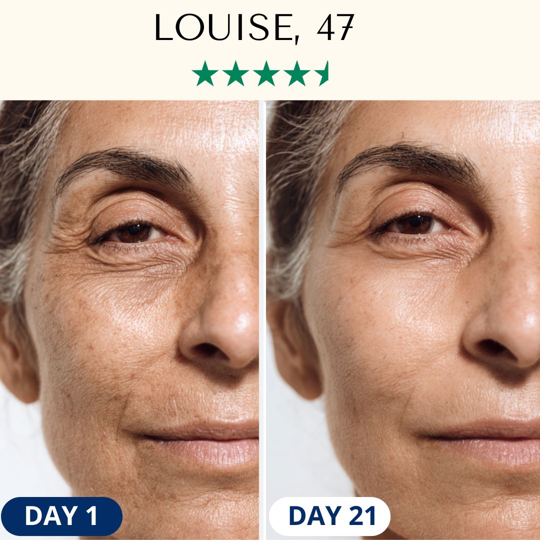 LightPro 7in1 LED Lifting Anti-Ageing