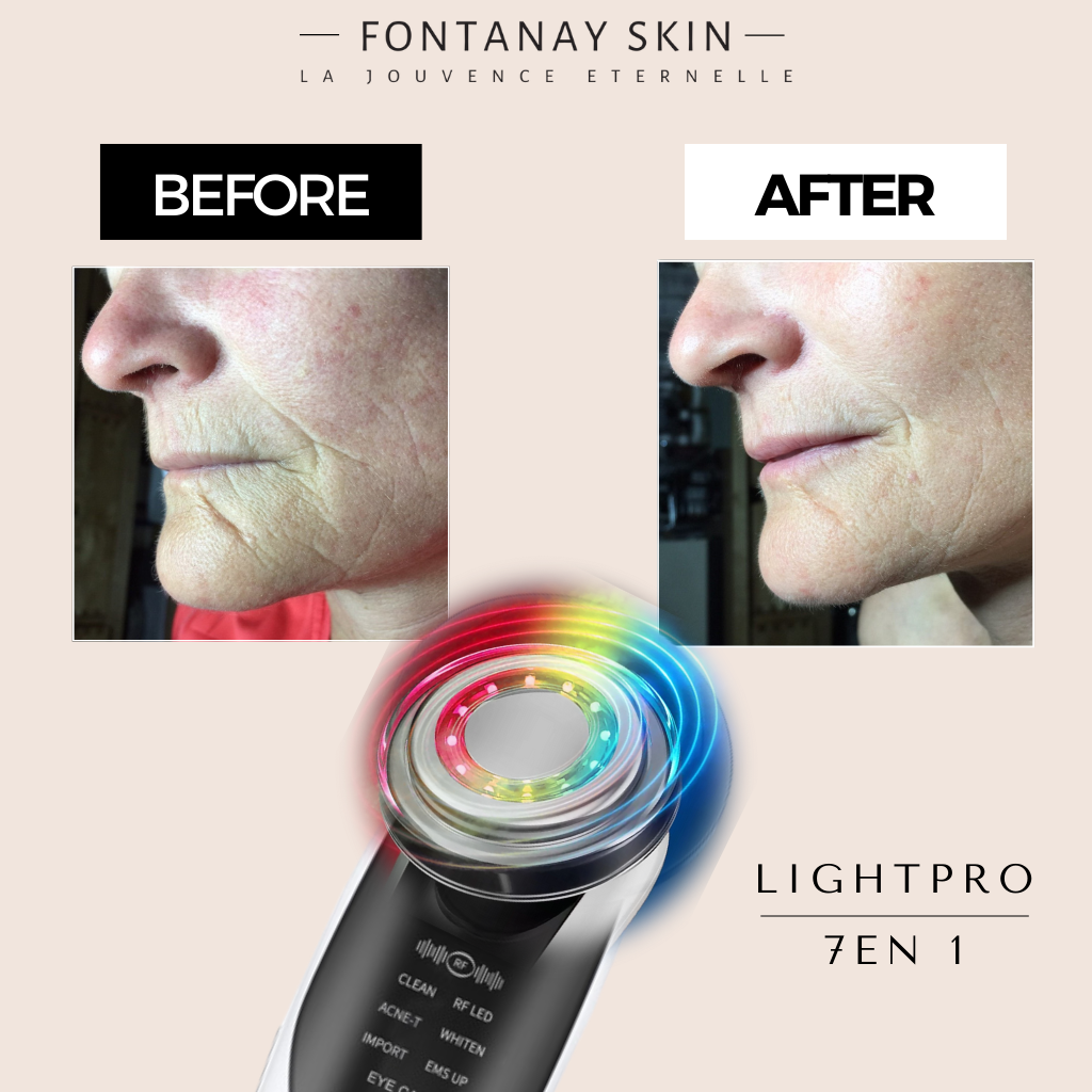 LightPro 7in1 Fontanay™ Lifting Light Therapy