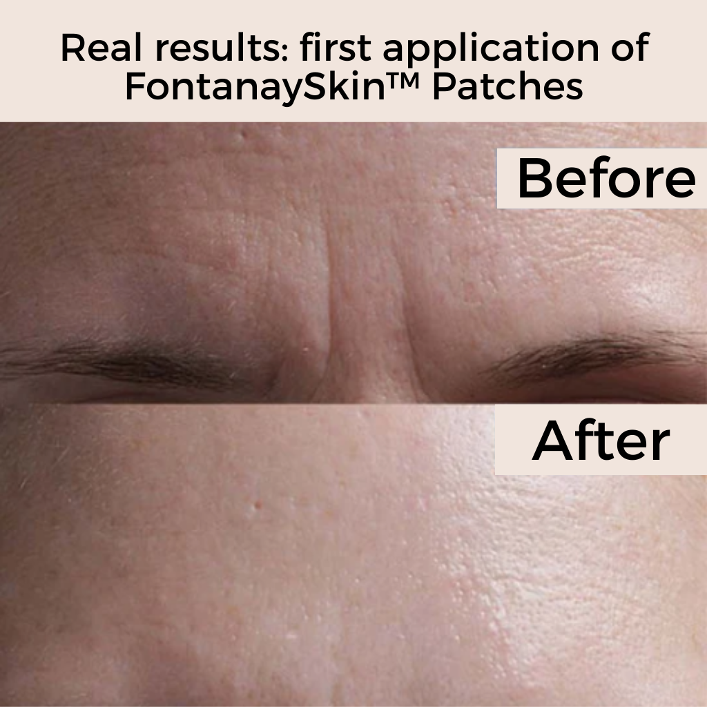 Anti-Wrinkle Reusable Face Patches Fontanay™