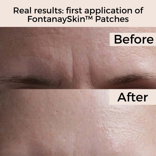 Anti-Wrinkle Reusable Face Patches Fontanay™